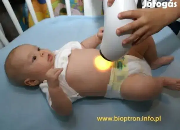 Bioptron lámpa kölcsönzés és bérlés