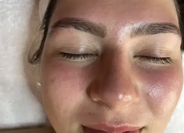 Luxury Skin Start prémium kezelések