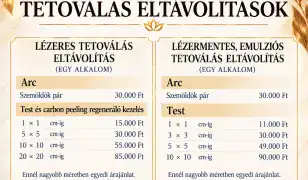 Pico Lézeres tetoválás eltávolítás
