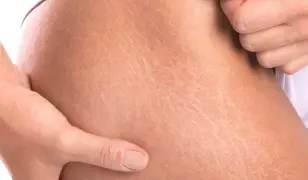 Speciális kezelések a Szilani-Beauty Szépségszalonban