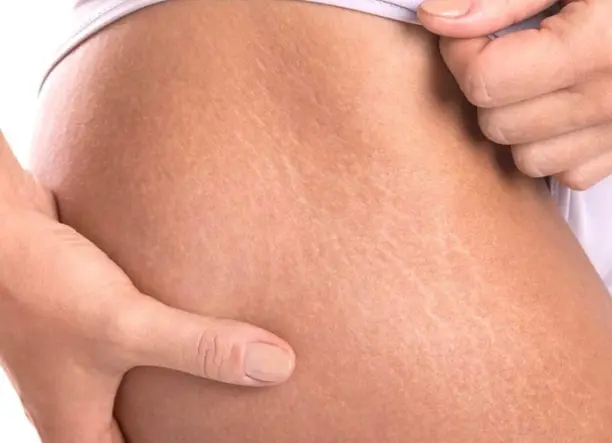Speciális kezelések a Szilani-Beauty Szépségszalonban