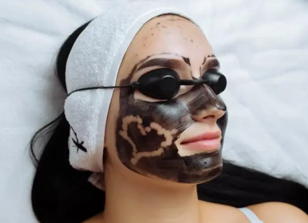 Carbon peeling a Váci47 szépségszalonban
