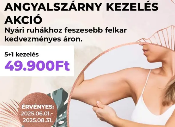 Angyalszárny kezelés a Szilani-Beauty Szépségszalonokban