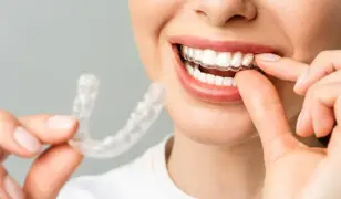 DigitalSmile Láthatatlan Fogszabályozó Kezelések