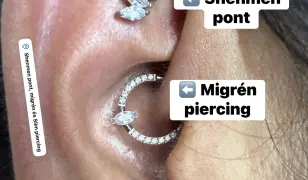 Shenmen pont, Migrén és Slim piercing