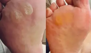 Gyógypedikűr szakszerűen!