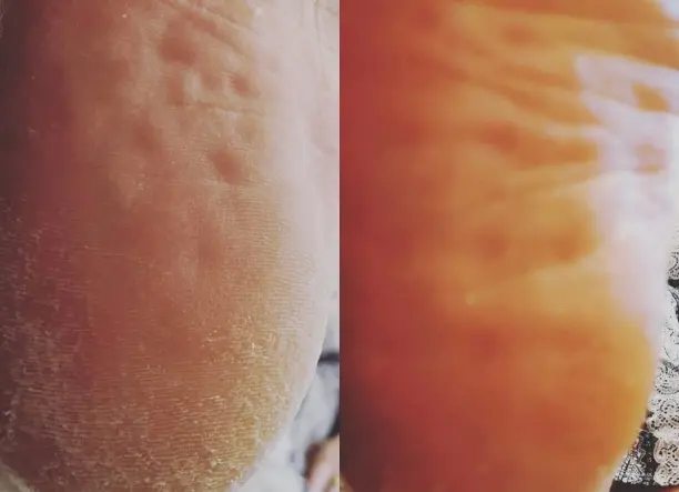 Gyógypedikűr szakszerűen!