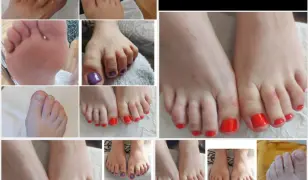 Gyógypedikűr háznál