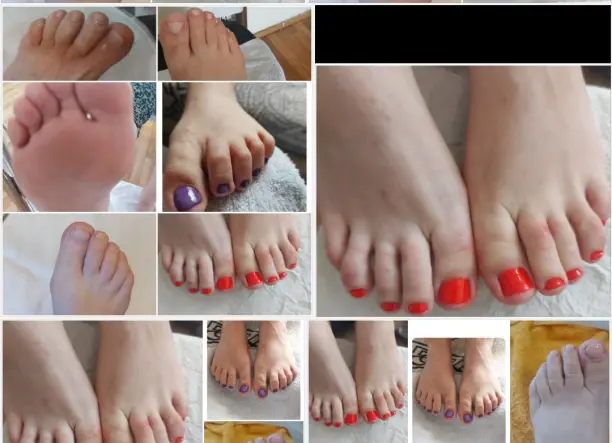 Gyógypedikűr háznál