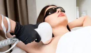 SHR lézeres szőrtelenítés - teljes test