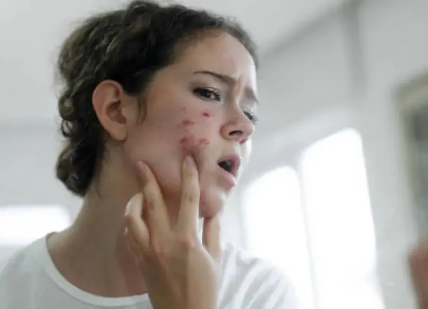 Tisztító arckezelés tiniknek