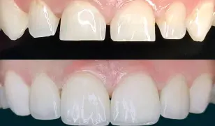 TriDent Fogászati Központ Budapest IV. kerület, Újpest