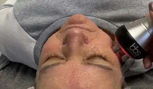 Tüntesd el az apró ráncokat és tisztítsd pórusaid!”