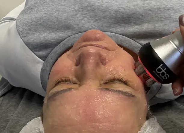 Tüntesd el az apró ráncokat és tisztítsd pórusaid!”