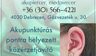 Akupunktúrás piercingek szakértőtől