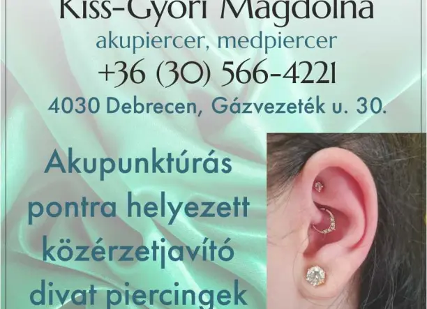 Akupunktúrás piercingek szakértőtől