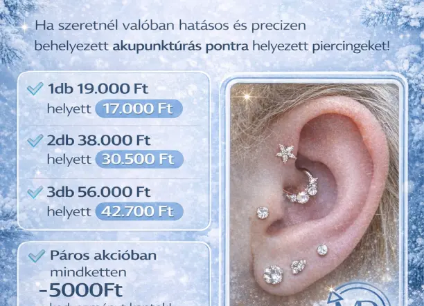 Akupunktúrás piercingek szakértőtől