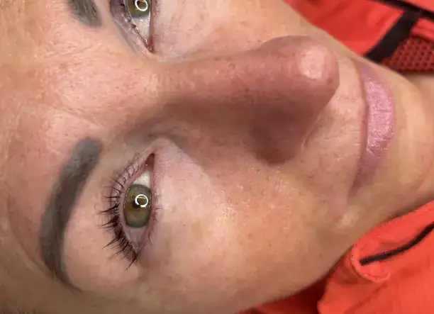 Anti-age, szőrtelenítés és szempillaépítés szakértői kezekkel!