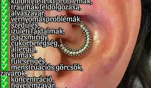 Shenmen pont, Migrén és Slim piercing GYŐR-BUDAPEST