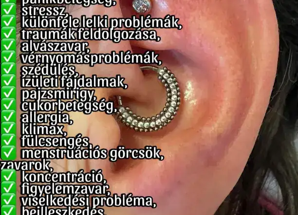 Shenmen pont, Migrén és Slim piercing GYŐR-BUDAPEST