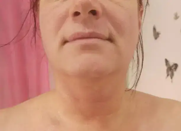 Tavaszi arctisztítás