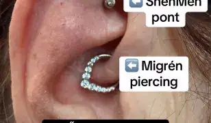 ShenMen pont & Migrén piercing GÉPI beméréssel