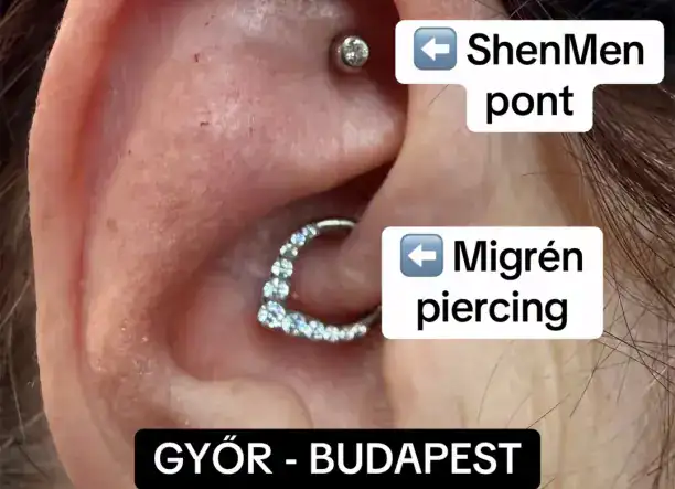 ShenMen pont & Migrén piercing GÉPI beméréssel